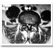 Pre-operative MRI