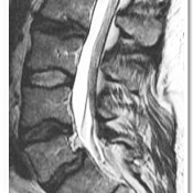 Pre-operative MRI