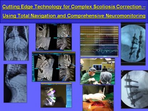 Cutting-Edge-Technology-for-Complex-Scoliosis-Correction-–-Using-Total-Navigation-and-Comprehensive-Neuromonitoring
